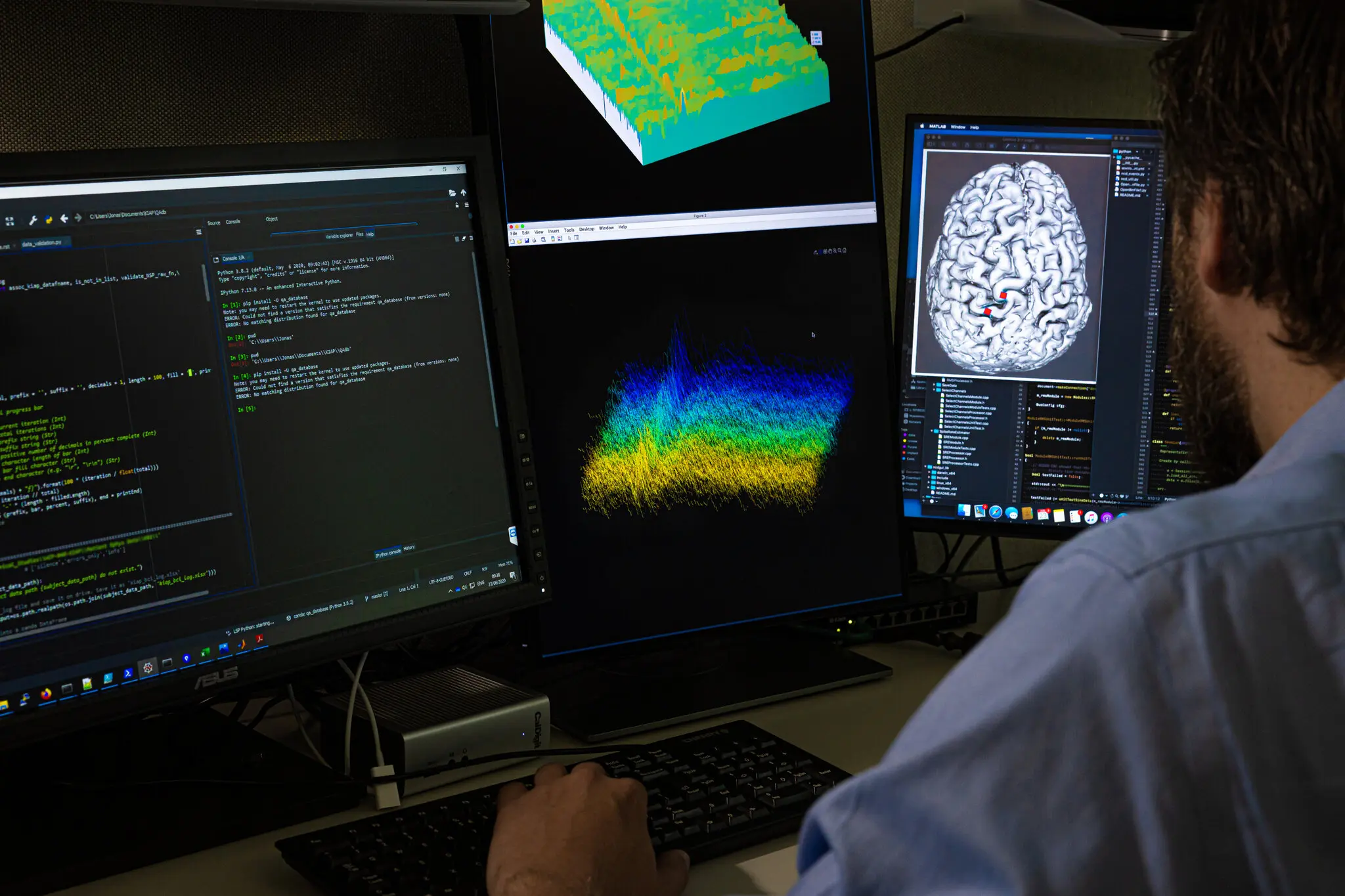 Locked-In Brain Communication